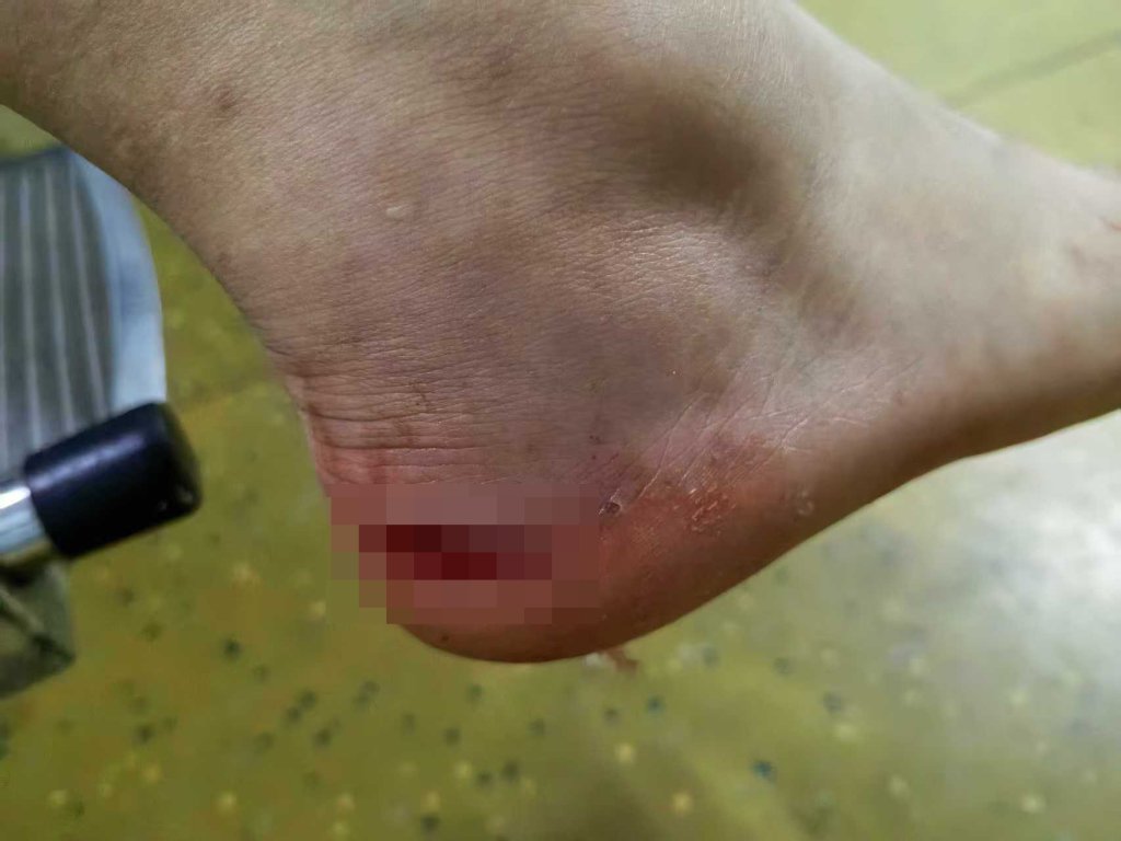 多名孩子在景区水池被瓷砖割伤，衡阳南岳文旅局：正沟通处理