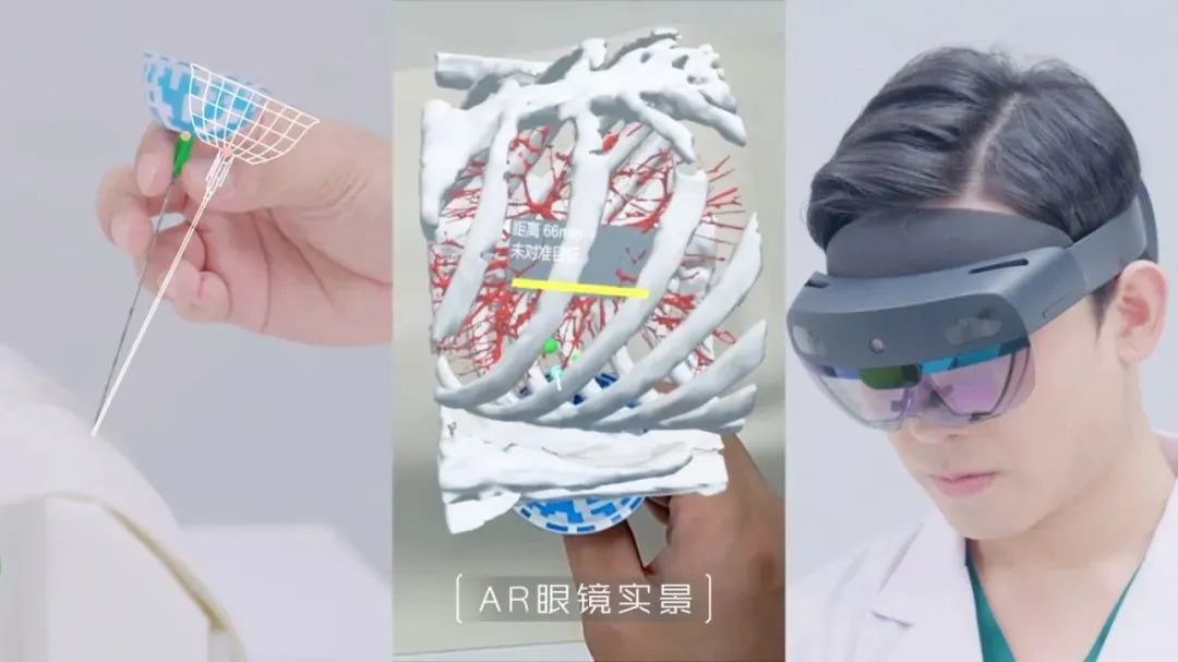 全球首创！复拓知达自研AI-AR导航设备获批，引领肺结节术中定位新时代